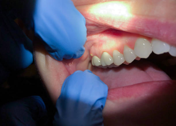 Best After-Hours Emergency Dentist in Bren Arrow, OK