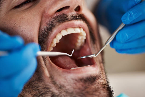 Best Pediatric Emergency Dentist in Bren Arrow, OK