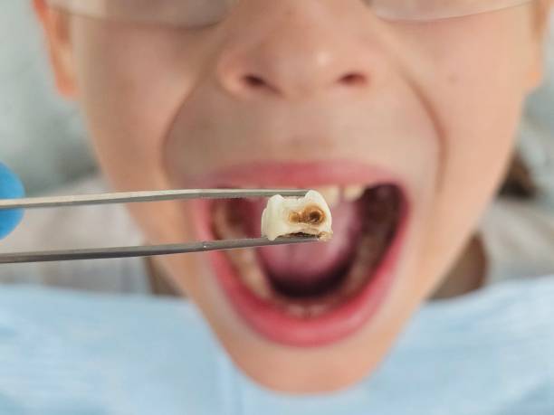 Best Emergency Dental Care for Trauma or Injury in Bren Arrow, OK